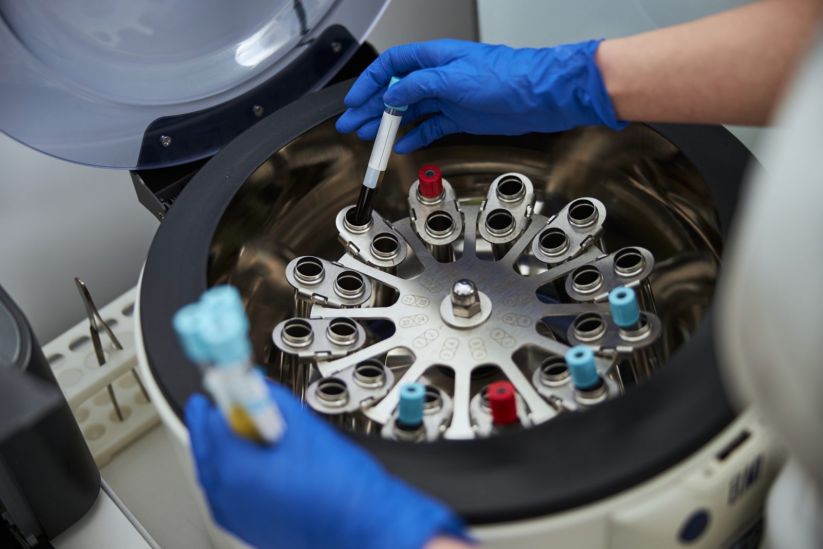 A lab technician in blue gloves loads capped blood sample tubes into the open rotor of a benchtop centrifuge.
